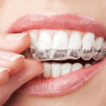 RESGATAR saúde e a estética bucal do paciente, desafios da ortodontia